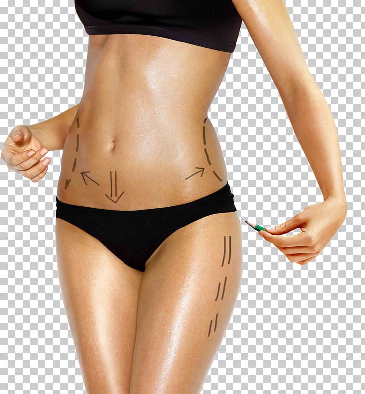 Body Contouring Liposuction Human Body Belt Lipectomy Surgery PNG, Clipart, Abdomen, Abdominoplasty, Active Undergarment, Adipose Tissue, Aesthetic Medicine Free PNG Download