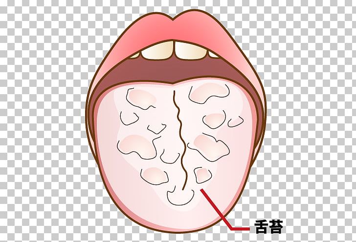 Mouthwash 歯科 Dentist 坂井医院 Tooth Decay PNG, Clipart, Caption, Cartoon, Cheek, Clinic, Dentist Free PNG Download