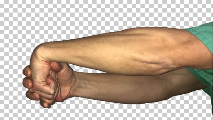 Thumb Tennis Elbow Wrist Golfer's Elbow PNG, Clipart,  Free PNG Download