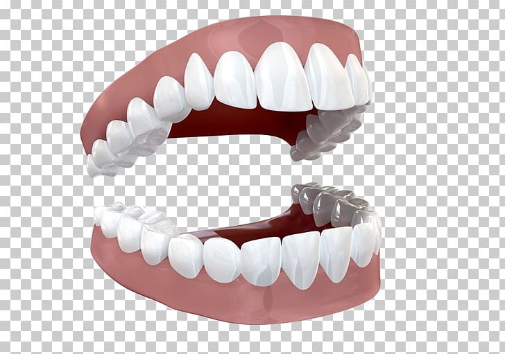 Human Tooth Stock Photography PNG, Clipart, Dental Braces, Euclidean Vector, Hand, Incisor, Jaw Free PNG Download