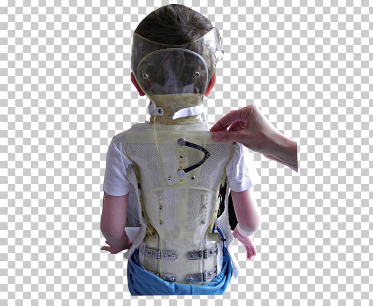 Corset T-shirt Bustier Orthotics Scoliosis PNG, Clipart, Back Brace, Bustier, Cervical Collar, Child, Clothing Free PNG Download