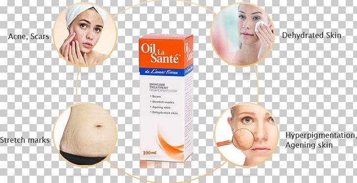Dryness Oil Health Face Dehydration PNG, Clipart, Chin, Dehydration, Dryness, Ear, Face Free PNG Download