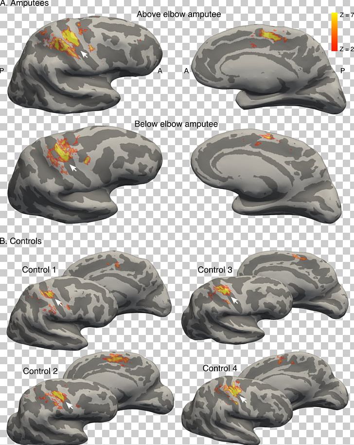 Brain Primary Somatosensory Cortex Finger Cerebral Cortex Nervous System PNG, Clipart, Amputation, Bicycle Helmet, Brain, Cap, Cerebral Cortex Free PNG Download