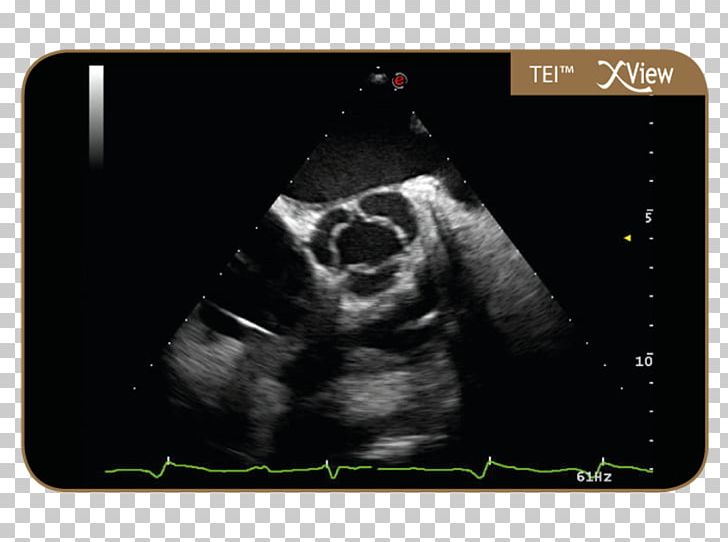 Radiology Skeletal Survey Ultrasonography Mylab Oy Positron Emission Tomography PNG, Clipart, 3 D, Computer, Computer Accessory, Electronics, Gadget Free PNG Download