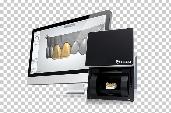 CAD/CAM Dentistry Regenerative Dentistry Dental Laboratory Computer-aided Design PNG, Clipart, 3shape, Articulator, Cadcam Dentistry, Computeraided Design, Cosmetic Dentistry Free PNG Download