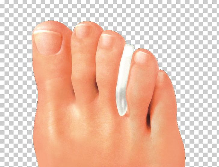 Toe Foot Digit Artikel Orthopaedics PNG, Clipart,  Free PNG Download