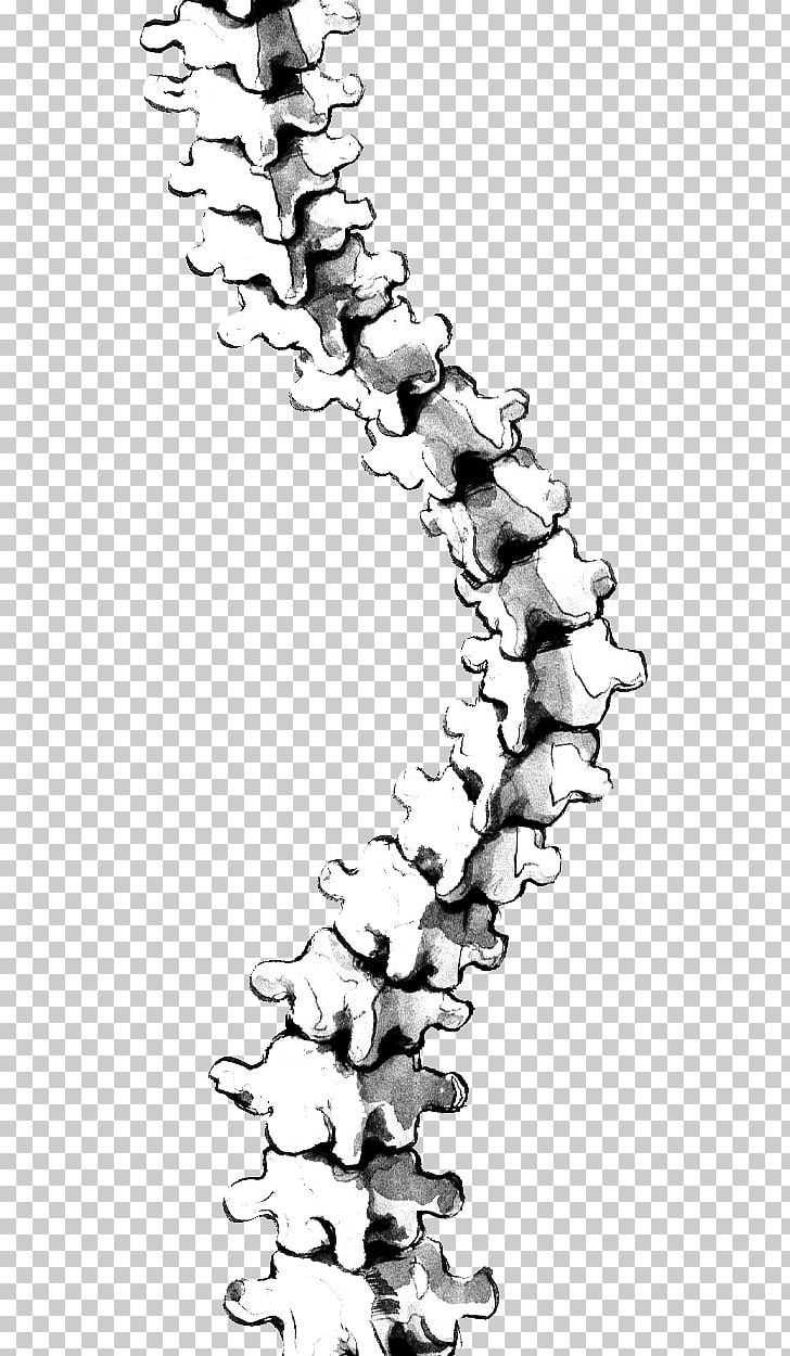 Scoliosis Vertebral Column Back Brace Drawing PNG, Clipart, Back Brace, Black And White, Body Jewelry, Curve, Human Back Free PNG Download