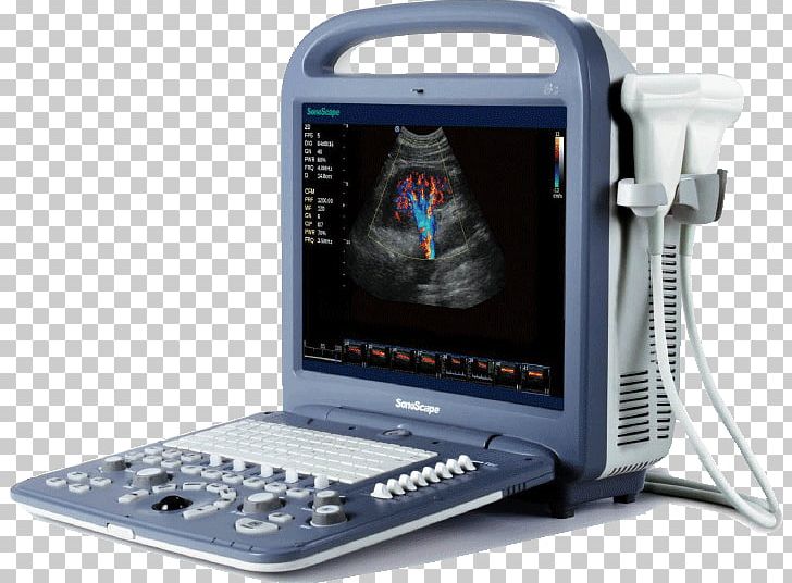 Doppler Echocardiography Portable Ultrasound Ultrasonography SonoScape Medical Corp PNG, Clipart, 3d Ultrasound, Display Device, Electronic Device, Electronics, Medical Diagnosis Free PNG Download