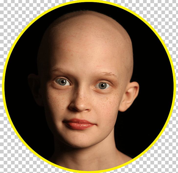 Kylie Jenner The Monster Cancer Eyebrow PNG, Clipart, Cancer, Celebrities, Cheek, Childhood Cancer, Chin Free PNG Download