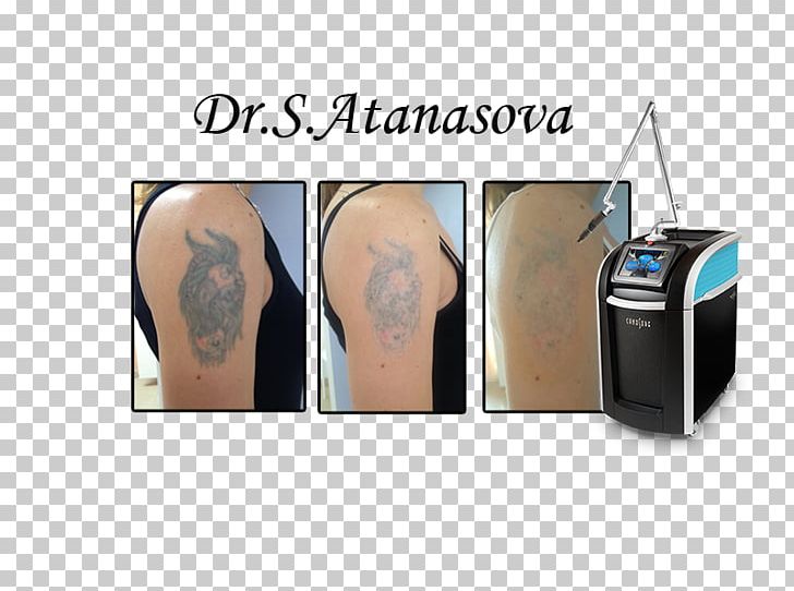 Ata-derma 0 Dermatology Tattoo Bulevard "Koprivshtitsa" PNG, Clipart, Abdomen, Arm, Dermatology, Info, Joint Free PNG Download