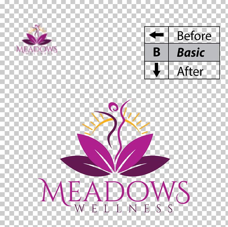 Meadows Wellness Beauty Parlour Abdomen Laser Hair Removal PNG, Clipart, Abdomen, Area, Beauty Parlour, Brand, Diagram Free PNG Download