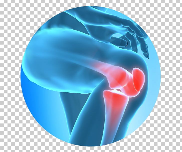 Knee Pain Injury Therapy Pain Management PNG, Clipart, Aqua, Blue, Electric Blue, Health, Injury Free PNG Download