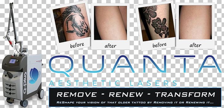 Flashpoint Tattoo Company Tattoo Removal Laser Cover-up PNG, Clipart, 2017, Advertising, Brand, British Columbia, Clinic Free PNG Download