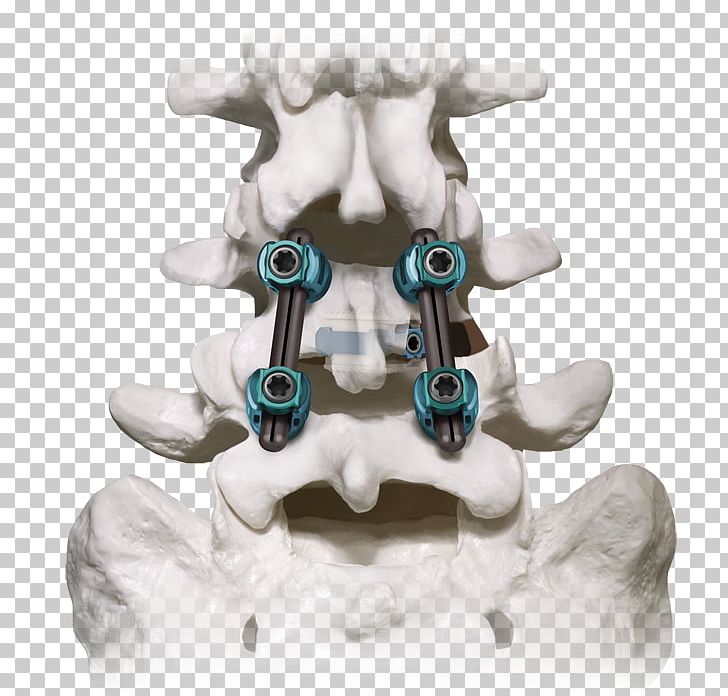 Figurine Jaw Turquoise PNG, Clipart, Bone, Figurine, Jaw, Taobao Copy Background, Turquoise Free PNG Download