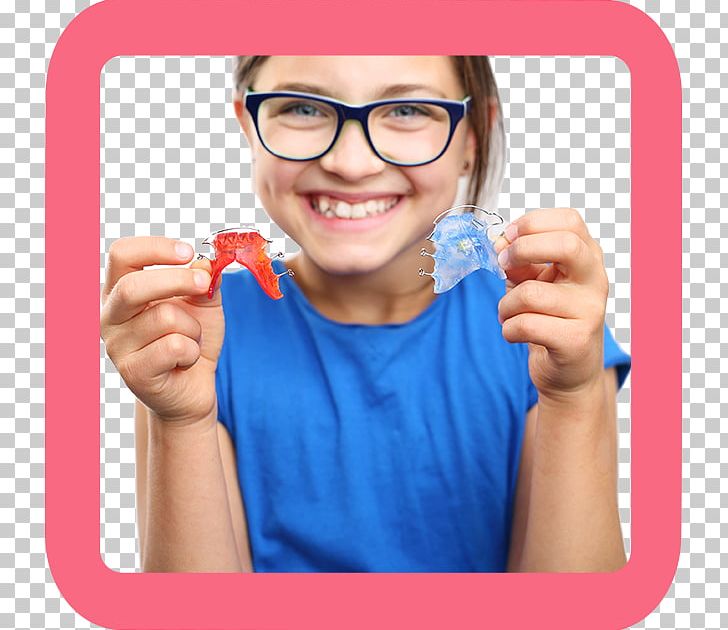 Orthodontics Dental Braces Dentistry Child PNG, Clipart, Child, Clinica Dental Sonrie Penonome, Crowding Of Teeth, Dental Arch, Dental Braces Free PNG Download