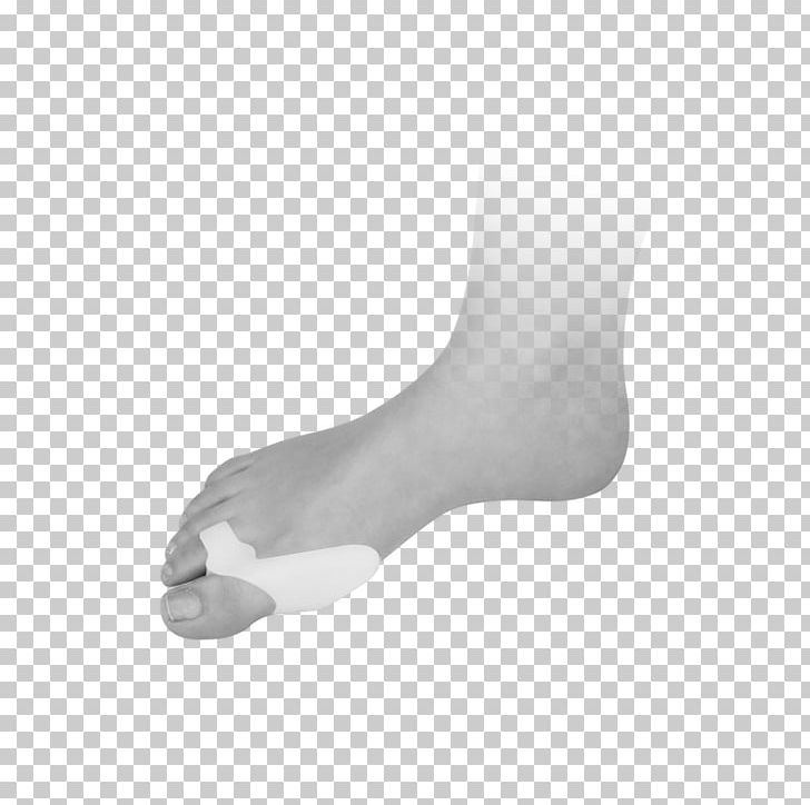 Foot Allegro Hallux Bunion PNG, Clipart, Allegro, Ankle, Arm, Auction, Bunion Free PNG Download