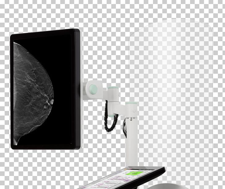 Medical Imaging Mammography Computer Monitor Accessory Ultrasonography PNG, Clipart, Computed Tomography, Computer Monitor Accessory, Display Resolution, Electronic Device, Hologic Free PNG Download