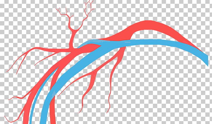 Vascular Surgery Tratamento Disease Vein PNG, Clipart, Artery, Blood Vessel, Disease, Graphic Design, Hand Free PNG Download