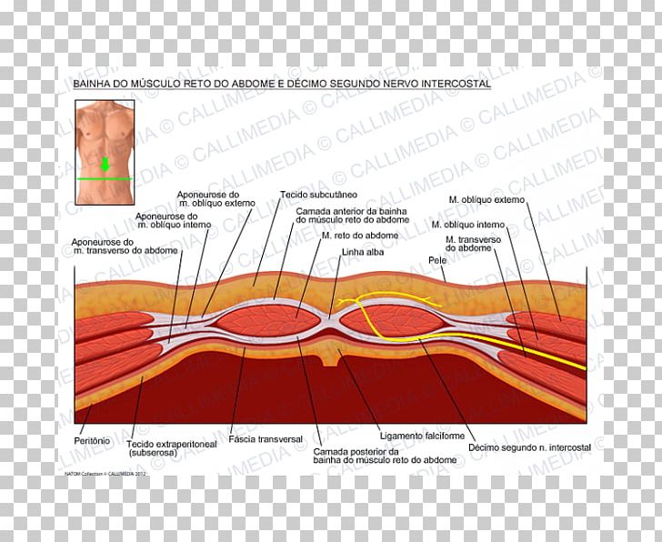 Nerve Rectus Abdominis Muscle Transversalis Fascia Rectus Sheath PNG, Clipart, Abdomen, Abdominal External Oblique Muscle, Abdominal Internal Oblique Muscle, Angle, Aponeurosis Free PNG Download