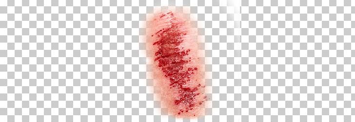 Light Wound PNG, Clipart, People, Wounds Free PNG Download