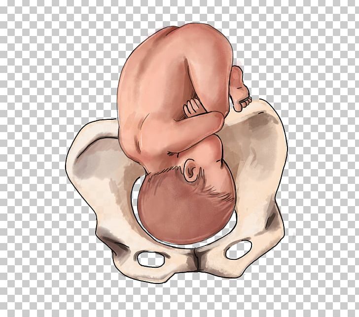 Fetal Position Childbirth Infant Breech Birth PNG, Clipart, Anterior, Arm, Baby, Belly, Belly Button Free PNG Download