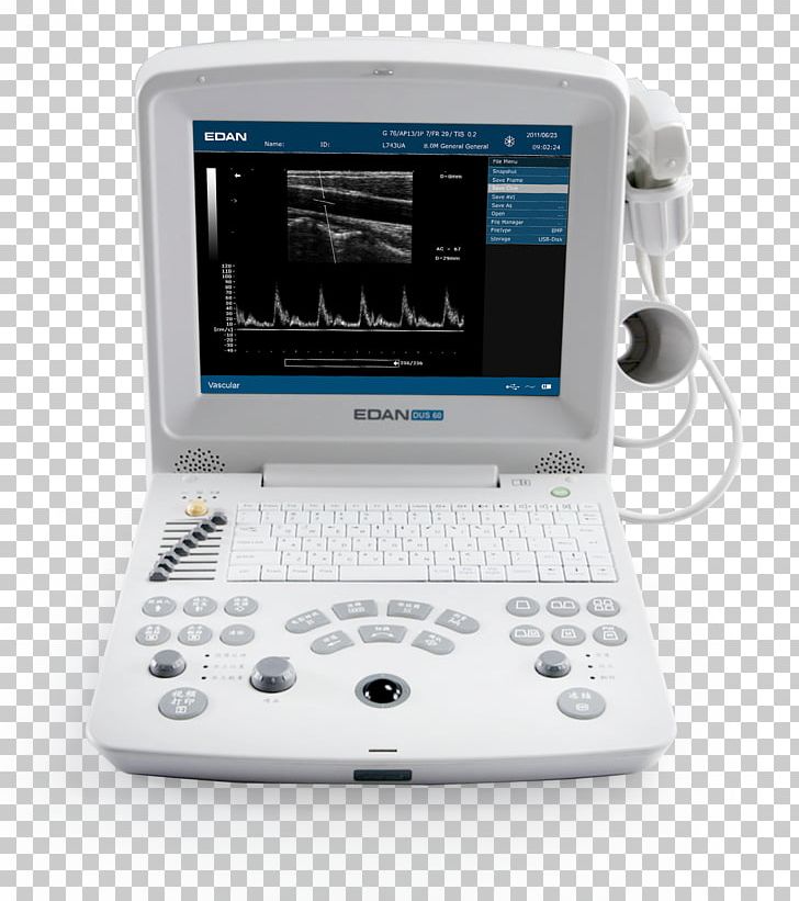 Ultrasonography Ultrasound Medical Imaging Electrocardiography Mindray PNG, Clipart, Display Device, Electronics, Gadget, Medical, Medical Diagnosis Free PNG Download