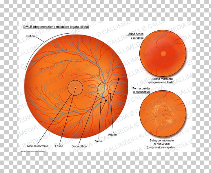 Macular Degeneration Macula Of Retina Old Age Atrophy PNG, Clipart, Age, Atrophy, Circle, Degeneration, Diagram Free PNG Download