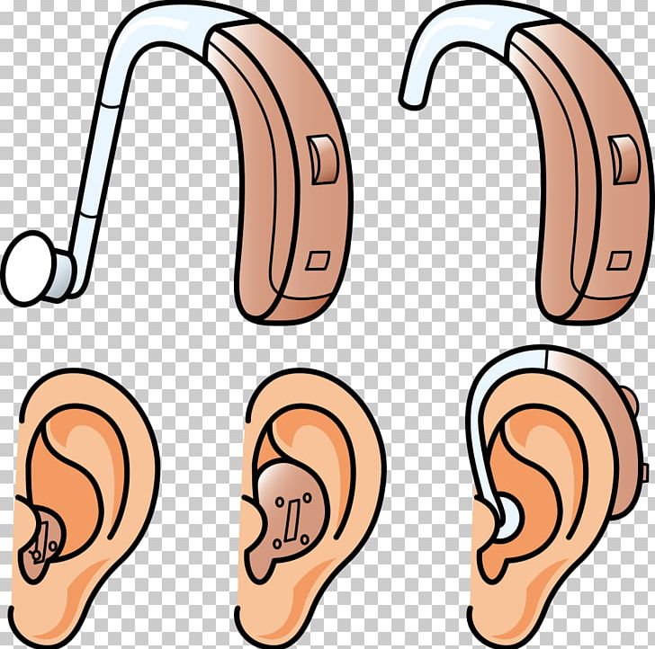 Hearing Aid Hearing Loss PNG, Clipart, Aids, Audiology, Cartoon, Cartoon Ear, Cat Ear Free PNG Download