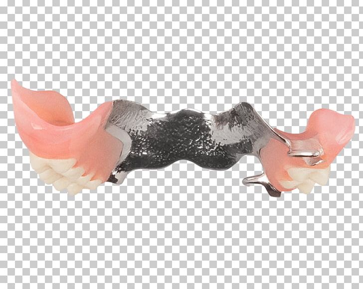 Removable Partial Denture Dentures Dentistry Aspen Dental Lazada Indonesia PNG, Clipart, Aspen Dental, Bukalapak, Combination, Combo, Dentistry Free PNG Download