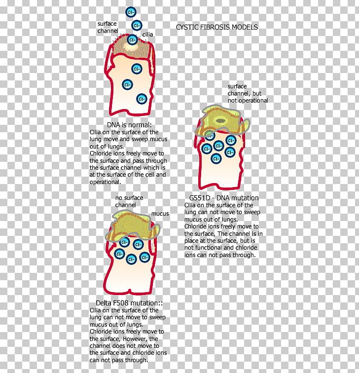 Cystic Fibrosis Transmembrane Conductance Regulator ΔF508 Mutation Chloride PNG, Clipart, Area, Chloride, Cystic Fibrosis, Depression, Disease Free PNG Download
