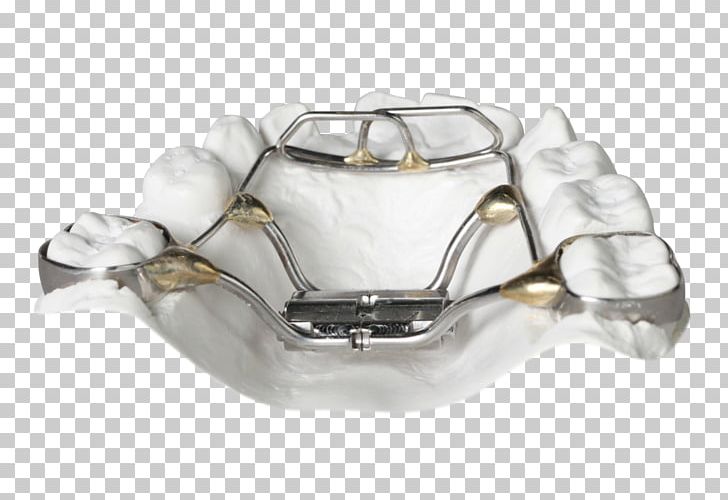 Orthodontics Palatal Expansion Cots Retainer Tongue PNG, Clipart, Bionator, Bod, Clear Aligners, Cots, David Gergen Free PNG Download