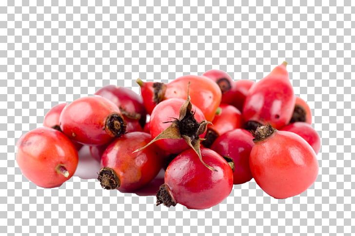 Zante Currant Barbados Cherry Rose Hip Food Accessory Fruit PNG, Clipart, Acerola, Acerola Family, Barbados Cherry, Berry, Cherry Free PNG Download