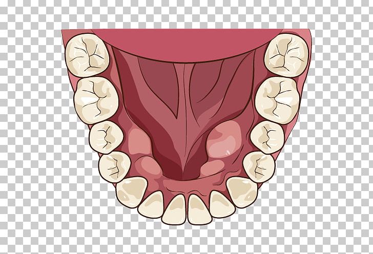 Tooth Alaleuanluu Dentist Jaw Mouth PNG, Clipart, Alaleuanluu, Alveolar Process, Bruxism, Dental, Dental Surgery Free PNG Download