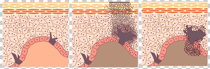 Melanin Skin Tyrosinase Biological Pigment PNG, Clipart, Angle, Arbutin