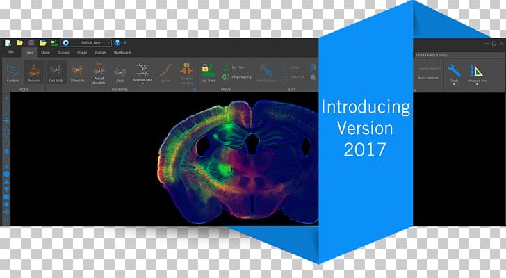 MBF Bioscience Stereology Neuroscience Neuron Sound PNG, Clipart, Brand, Data, Data Collection, Gadget, Graphic Design Free PNG Download