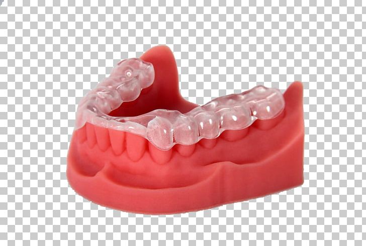 3D Printing Dentistry EnvisionTEC Printer PNG, Clipart, 3d Printing, Acrylonitrile Butadiene Styrene, Crown, Dental Implant, Dentistry Free PNG Download