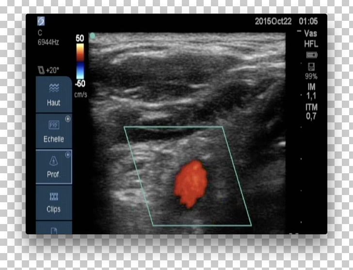 Medical Imaging Magnetic Resonance Imaging Screenshot Medicine PNG, Clipart, Blood Circulation, Joint, Magnetic Resonance Imaging, Medical, Medical Imaging Free PNG Download