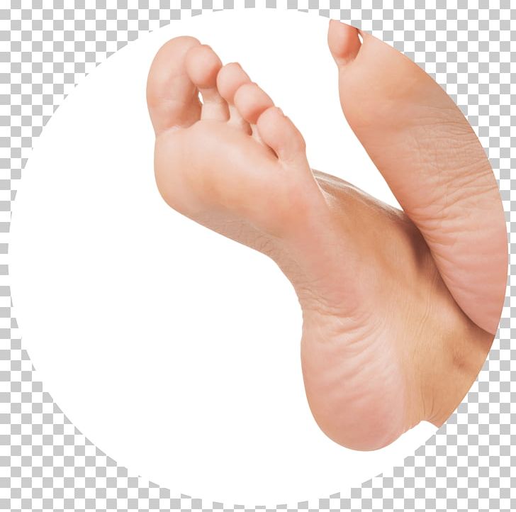 Toes On The Go: Michele Kraft PNG, Clipart, Ankle, Arm, Body Odor, Clubfoot, Diseases Of The Foot Free PNG Download