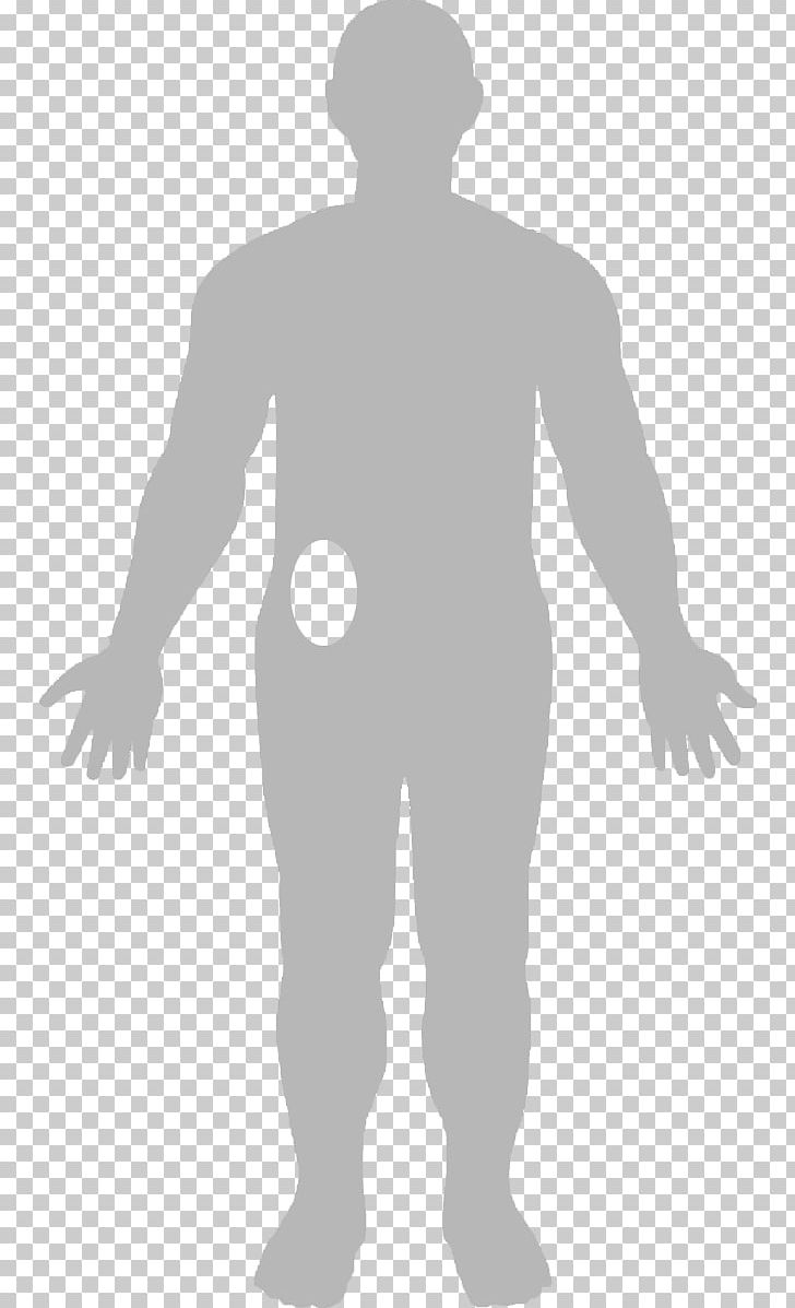 Gastric Bypass Surgery Obesity Roux-en-Y Anastomosis Radiation Therapy PNG, Clipart, Angle, Arm, Art, Bariatric Surgery, Fictional Character Free PNG Download