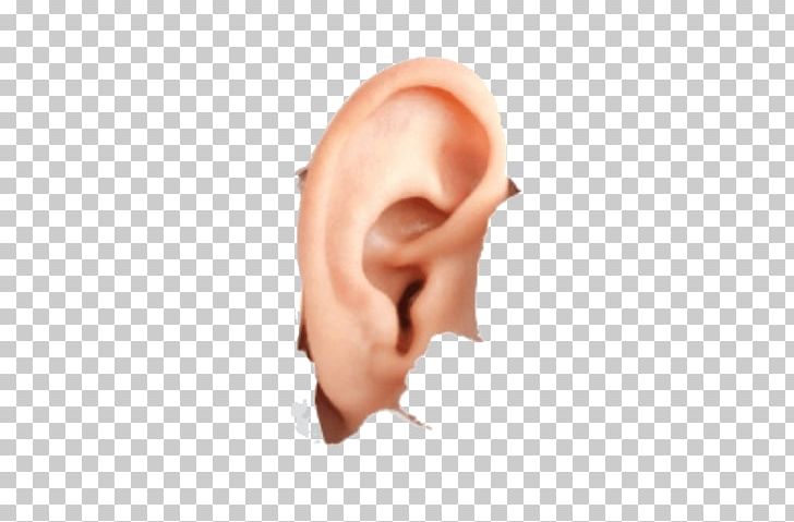 Hearing Aid Hyperacusis Earwax PNG, Clipart, Cheek, Chin, Ear, Ear Canal, Ear Pain Free PNG Download