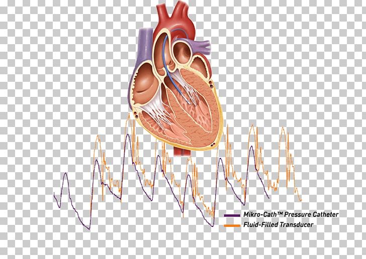 Cardiac Catheterization Heart Ailment Cath Lab PNG, Clipart, Cardiac Catheterization, Cardiology, Catheter, Cath Lab, Ear Free PNG Download