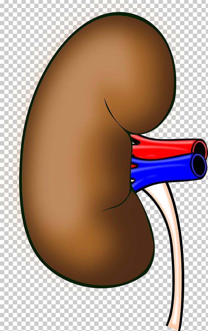 Kidney Transplantation Organ PNG, Clipart, Anatomy, Arm, Beak, Chronic Kidney Disease, Clip Art Free PNG Download