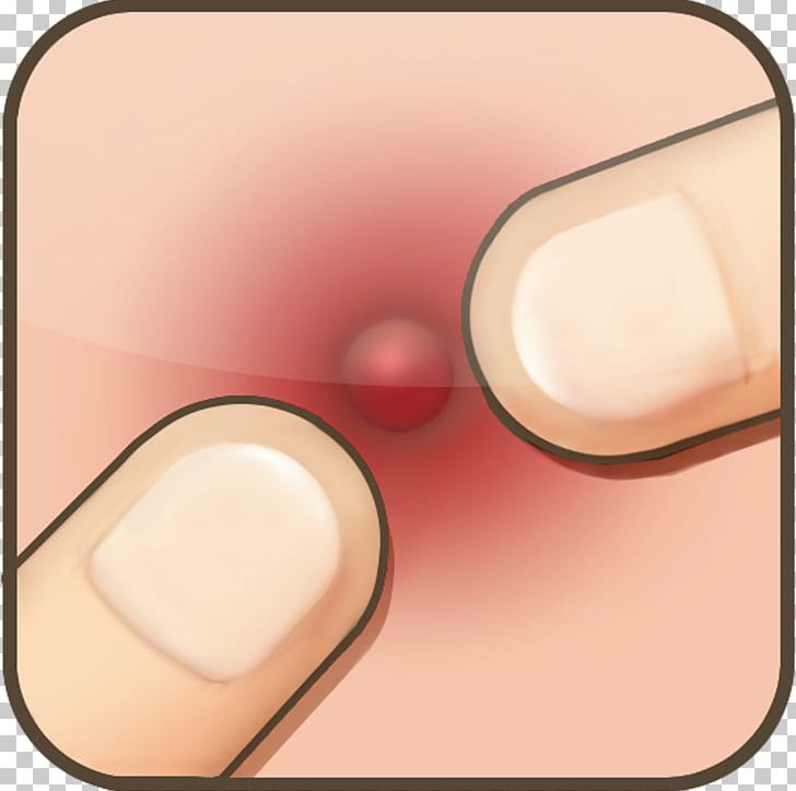 Pimple Acne Kindle Fire App Store Flappy Bird PNG, Clipart, Acne, App Store, Finger, Flappy Bird, Game Free PNG Download