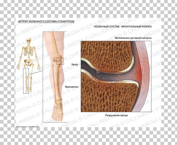 Shoulder Fibular Collateral Ligament Knee Shoe PNG, Clipart, Angle, Art, Fibular Collateral Ligament, Joint, Knee Free PNG Download