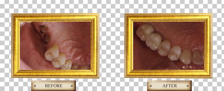 Painting Frames Jaw PNG, Clipart, Artwork, Jaw, Painting, Picture Frame, Picture Frames Free PNG Download