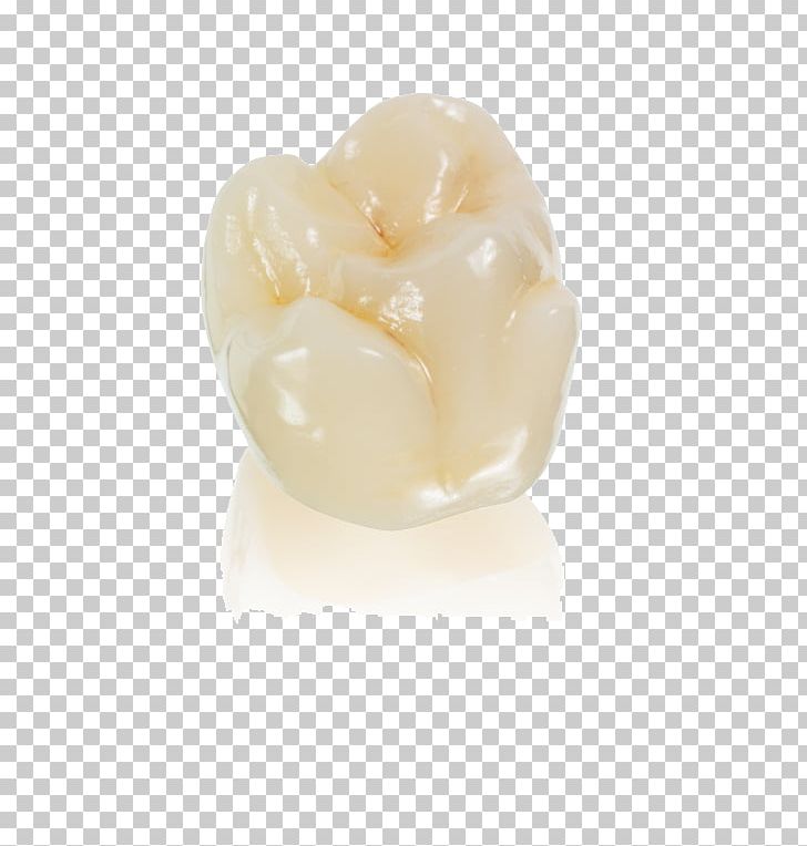 Vitallab PNG, Clipart, Aesthetics, Bridge, Crown, Crystallize, Dental Implant Free PNG Download