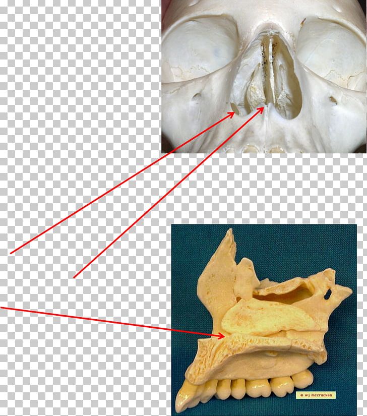 Bone Maxilla Anatomy Joint Skeletal Pneumaticity PNG, Clipart, Anatomy, Bone, Cartilage, Coronoid Process Of The Ulna, Fantasy Free PNG Download