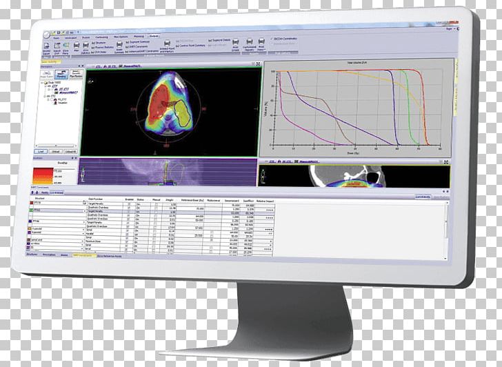 Radiation Therapy Radiation Treatment Planning Surgery Patient PNG, Clipart, Cancer, Computer Monitor, Computer Monitors, Display Device, Elekta Free PNG Download