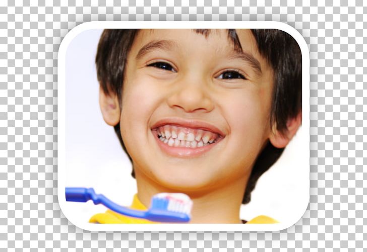 Tooth Brushing Pediatric Dentistry Child Human Tooth PNG, Clipart, Brush Teeth, Cheek, Child, Chin, Closeup Free PNG Download