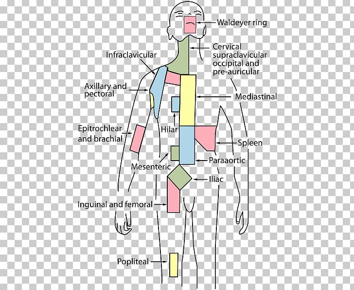 External Iliac Lymph Nodes Internal Iliac Lymph Nodes Common Iliac Artery Paraaortic Lymph Nodes PNG, Clipart, Anatomy, Angle, Aorta, Area, Common Iliac Artery Free PNG Download